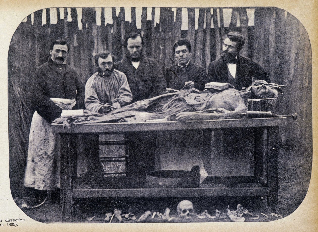 Rozbiór, v.1865. autorstwa Unknown photographer