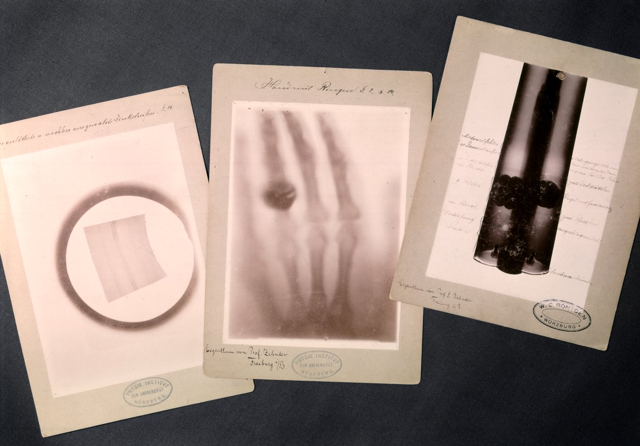 Oryginalne radiogramy Roentgena (radiografia) autorstwa Wilhelm (after) Röntgen