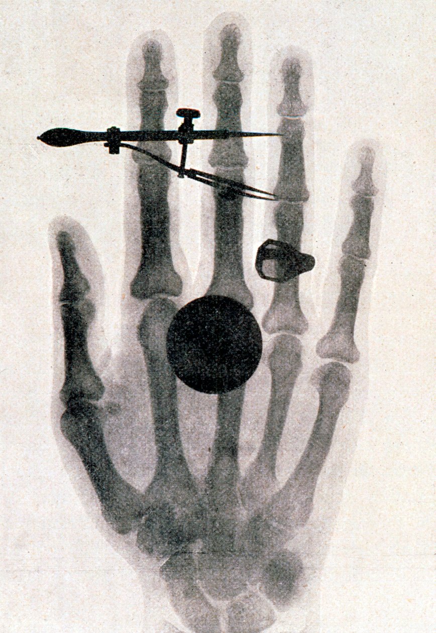 Zdjęcie rentgenowskie ręki żony Wilhelma Roentgena, 1896 autorstwa Wilhelm Conrad Rontgen