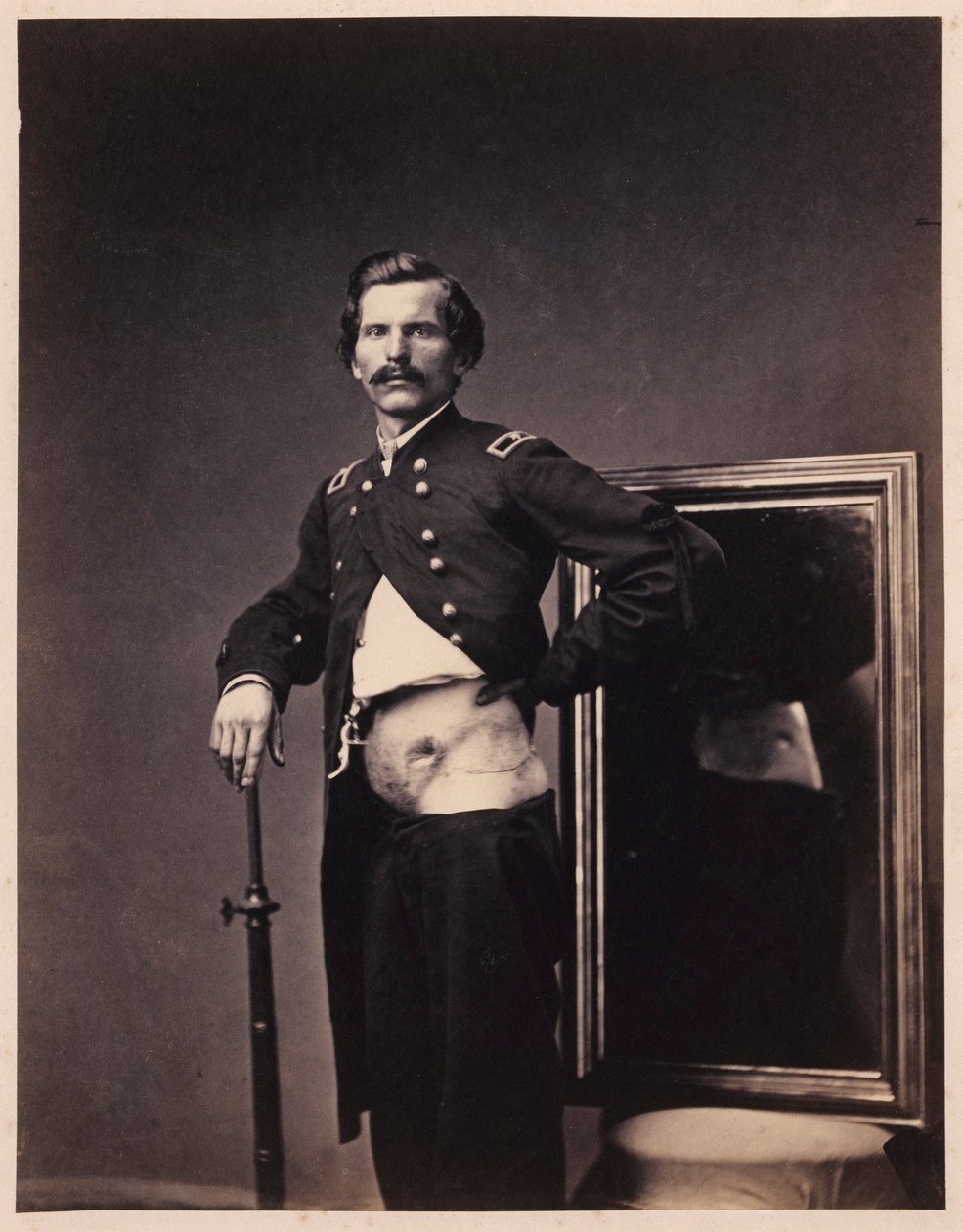 Major H. A. Barnum, rekonwalescencja po penetrującej ranie postrzałowej brzucha z perforacją lewego biodra, z katalogu fotograficznego sekcji chirurgicznej autorstwa William Bell