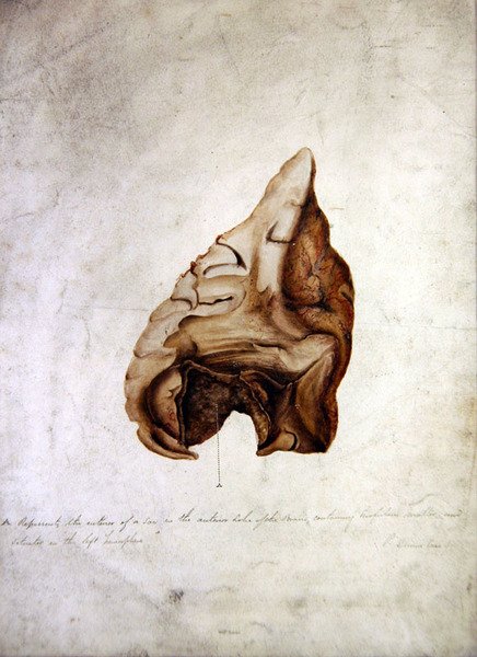 Study of Brain I, ok.1850 (akwarela na papierze) autorstwa William Lover