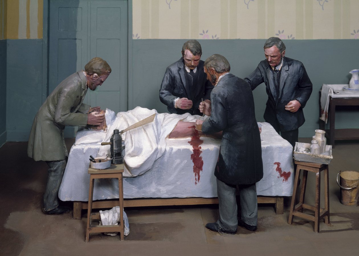 Chirurgiczne środki antyseptyczne Operacja antyseptyczna autorstwa Ferdinand Georg Waldmuller