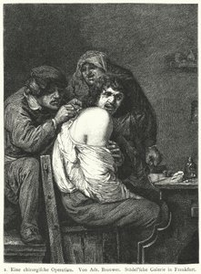 Operacja z tyłu autorstwa Adriaen (after) Brouwer