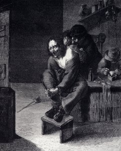 Operacja chirurgiczna Grawerowanie według obrazu Adriaena Brouwera (zrobił 1608) XVII wiek autorstwa Adriaen (after) Brouwer