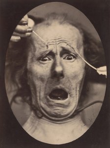 Elektrofizjologia, ryc. 64, 1854-56, wydrukowany 1862.