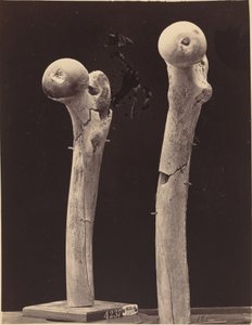 Okazy złamań postrzałowych kości udowej autorstwa American 19th Century
