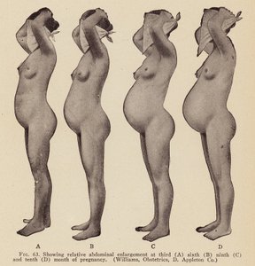 Oznaki i objawy ciąży (zdjęcie czarno-białe) autorstwa American Photographer