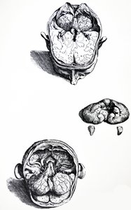 Płyty z siódmej księgi De Humani Corporis Fabrica autorstwa Andreas Vesalius