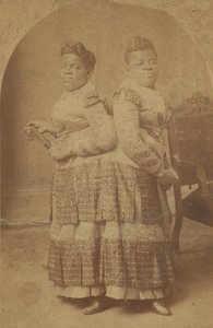 Odbitka albuminowa Millie i Christine McCoy, 1880-1890.
