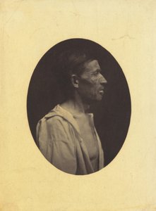 Widziany z profilu portret 42-letniego mężczyzny, oszołomionego nadużywaniem alkoholu..., 1854-1856.