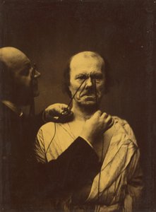 Agresja, niegodziwość, 1854-1856, druk 1862. autorstwa Duchenne de Boulogne
