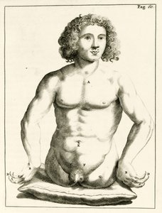 Przykład wrodzonych wad wrodzonych autorstwa Frederika Dekkersa, 1694 autorstwa Dutch School