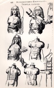 Operacja raka piersi, z Armamentarii Chirurgici Johannesa Schultesa (1595-1645) opublikowanej w Amsterdamie, 1672 autorstwa Dutch School