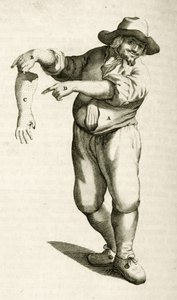 Usuwanie martwego naskórka z krostami, z Ćwiczeń praktycznych z metod medycznych Frederika Dekkersa, 1694 autorstwa Dutch School