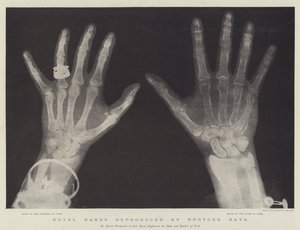 Royal Hands reprodukowana przez Rontgen Rays (grafika) autorstwa English School