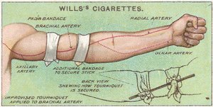 Opaska uciskowa nr 11 z serii kart Willss Cigarettes z serii Pierwsza pomoc, 1913 r autorstwa English School