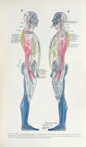 Ryc. 381 i 382 Układ nerwowy, z Semiologie des Affections du System Nerveux J. Dejerine, 1914 autorstwa French School