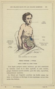 Charakterystyczne zmiany durowe (kolor lito) autorstwa French School