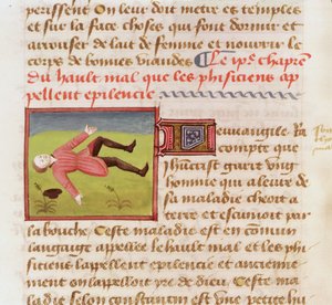 Ms 22532 Pacjent w ataku epilepsji, z Księgi właściwości rzeczy Barthelemy langlais, c. 1410-15 autorstwa French School