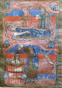 Ms 250 Dropsical kobieta wyleczona w łaźniach przez św. Radegundę, z Życia św. Radegundy autorstwa French School