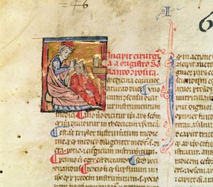 Pani Lat. 7134 fol.1 Trepanacja, z Chirurgii Maitre Rolandi autorstwa French School