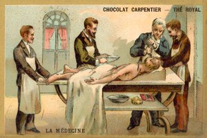 Trepanowanie (chromolitho) autorstwa French School
