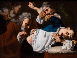Operacja, około 1753/54 (olej na płótnie) autorstwa Gaspare Traversi