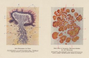 Actinomyces bovis (litografia kolorowa) autorstwa German School