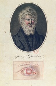 Georg Gamber, albinos autorstwa German School