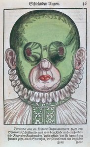 Maska do leczenia zeza, z Ophthalmodouleia Georga Bartischa (1535-1636) wydana w Dreźnie w 1583 r. (kolorowy drzeworyt) autorstwa German School