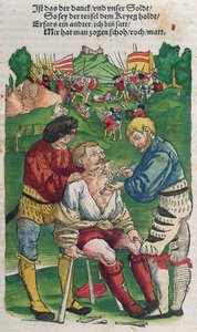 Usunięcie strzały, ilustracja z Feldtbuch der Wundartzney autorstwa Hansa von Gersdorffa, 1540 autorstwa German School