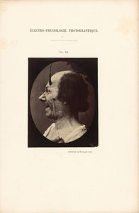 Elektrofizjologia fotograficzna, rysunek 39 autorstwa Guillaume Benjamin Duchenne