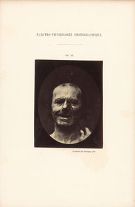 Elektrofizjologia fotograficzna, rysunek 53 autorstwa Guillaume Benjamin Duchenne