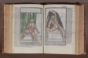 Anatomia kobiety, z komentarzy do anatomii świata z najwspanialszymi dodatkami, autorstwa Jacopo Berengario da Carpi (ok.1460-ok.1530) opublikowanych w Bolonii, 1521 (kolorowy drzeworyt) autorstwa Italian School