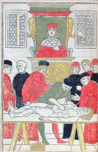Rozcięcie, ilustracja z „Fasciculus Medicinae” Johannesa de Ketham (zm. 1490) 1493 (drzewryt) autorstwa Italian School