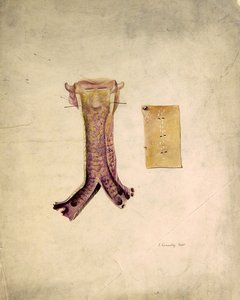 Badanie tchawicy (akwarela na papierze) autorstwa J. Counolly