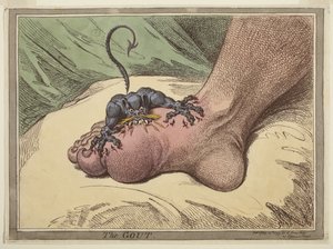 Podagra autorstwa James Gillray
