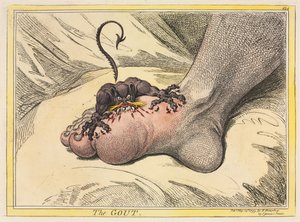Podagra autorstwa James Gillray