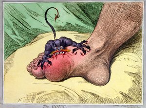Podagra, opublikowana przez Hannah Humphrey w 1799 (ręcznie barwiona akwaforta na miękkim podłożu)