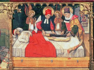 126-0035321 SS. Kosmas i Damian przeszczepiają nogę Etiopczyka na kikut diakona Justyniana;