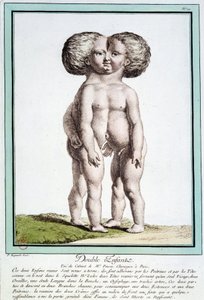 Dzieci syjamskie - w „Odchyleniach natury” autorstwa Régnault autorstwa Jean Baptiste Regnault