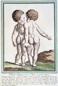 Dzieci syjamskie - w „Odchyleniach natury” autorstwa Régnault autorstwa Jean Baptiste Regnault