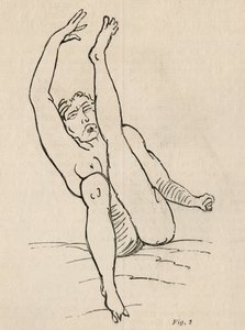 Epilepsja histeryczna, atak, wygięcia, ryc. 2 z „Iconographie Photographique de La Salpetriere” Bourneville et P. Regnard, Paryż, 1876 autorstwa Jean Francois Badoureau