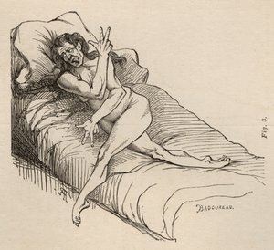 Epilepsja histeryczna, atak, wygięcia, ryc. 3 z „Iconographie Photographique de La Salpetriere” Bourneville et P. Regnard, Paryż, 1876 autorstwa Jean Francois Badoureau