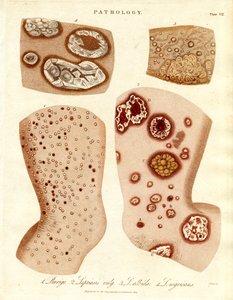 Patologiczne choroby skóry: Schurigie;Leprous Skin;Pallada i Impetigo autorstwa John Pass