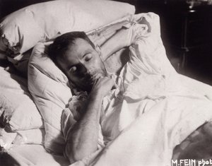 Egon Schiele na łożu śmierci, 1918. autorstwa Martha Fein