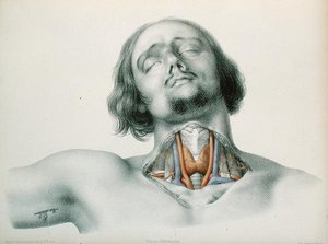Przekrój gardła z „Anomalies Arterielles” Jean-Baptiste-Leon Dubreuil