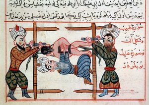 Redukcja złamania. Miniatura z traktatu medycyny tureckiej autorstwa Sharafa al-din autorstwa Ottoman School