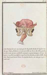 Schemat przekrojowy dziecka wyciągniętego z macicy za ramię, z książki Madame Angelique Le Boursier du Coudray (1714-94) sztychowanej przez J. Roberta, 1783 autorstwa P. Chapparre