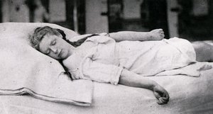 Désiré-Magloire Bourneville i Paul Regnard Fotograficzna ikonografia Salpêtrière